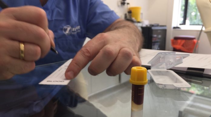 test immunite londres coronavirus